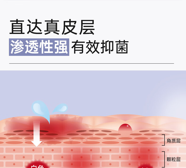 Rui Mishu 芮洣舒银离子皮肤抑菌液100ml