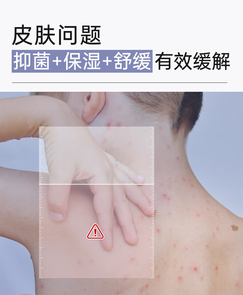 Rui Mishu 芮洣舒银离子皮肤抑菌液100ml
