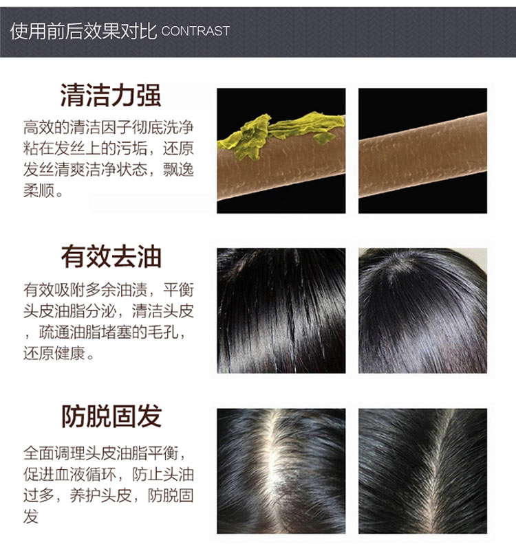 Alpecin 德国阿佩辛药用脂溢性脱发油性发质洗发水 海外本土原版