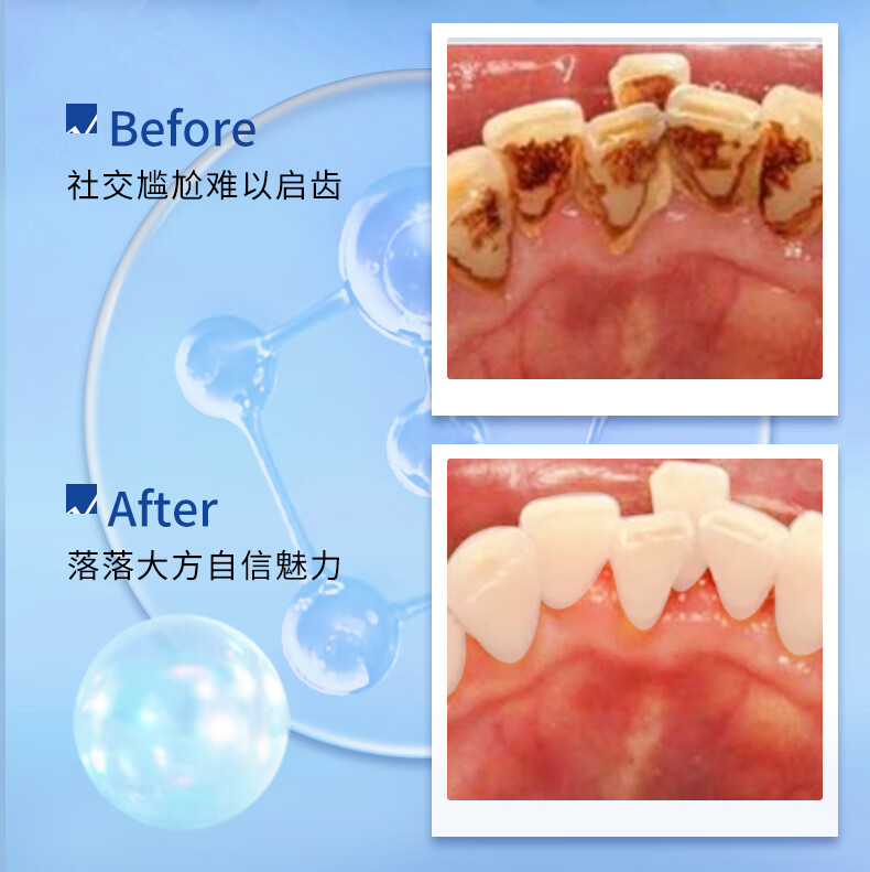 DentalDoctor ʿȥ 120g