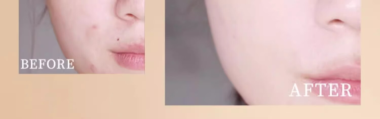 MAOGEPING ëƽݻӽ۵Һ װ10g+滻װ10g